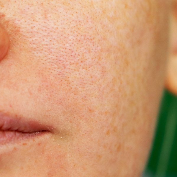 Unveiling the Secret: Can Oil-Based Skincare Actually Minimize Pores After 40?