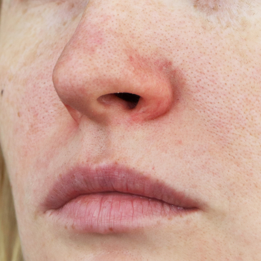 Skin Inflammation & Allergies: A Holistic Perspective